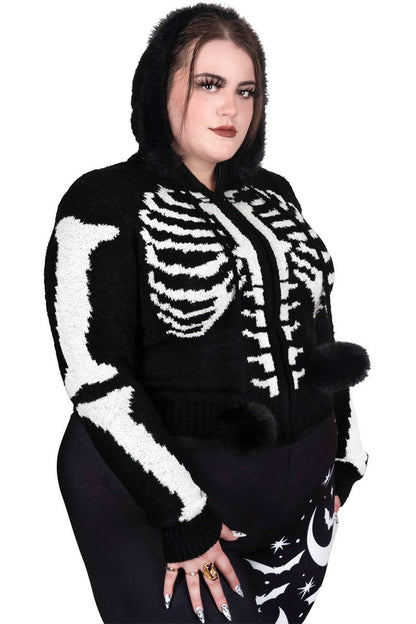 Bony Rib Cage Skeleton Fur Zip Sweater [BLACK/WHITE]